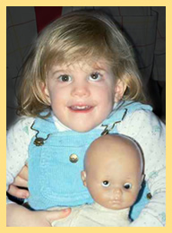 Example of a Child with Strabismus